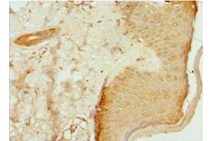 Immunohistochemistry of paraffin-embedded human skin tissue using ABIN7147369 at dilution of 1:100 (ITGB3BP anticorps  (AA 1-177))