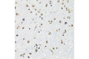 Immunohistochemistry of paraffin-embedded mouse brain using SFPQ antibody (ABIN5970351) at dilution of 1/100 (40x lens). (SFPQ anticorps)