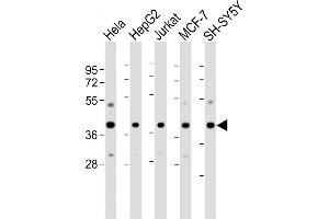 All lanes : Anti-RAE1 Antibody (N-Term) at 1:2000-1:4000 dilution Lane 1: Hela whole cell lysate Lane 2: HepG2 whole cell lysate Lane 3: Jurkat whole cell lysate Lane 4: MCF-7 whole cell lysate Lane 5: SH-SY5Y whole cell lysate Lysates/proteins at 20 μg per lane. (RAE1 anticorps  (AA 19-42))