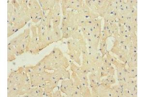 Immunohistochemistry of paraffin-embedded human heart tissue using ABIN7171931 at dilution of 1:100 (TTC32 anticorps  (AA 1-151))