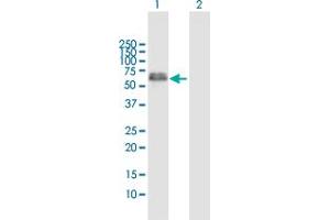 Western Blot analysis of XRCC4 expression in transfected 293T cell line by XRCC4 MaxPab polyclonal antibody. (XRCC4 anticorps  (AA 1-336))
