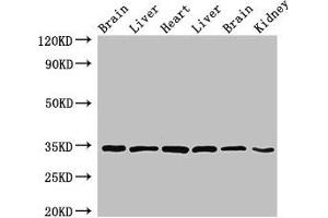 Western Blot Positive WB detected in: Rat brain tissue, Rat liver tissue, Mouse heart tissue, Mouse liver tissue, Mouse brain tissue, Mouse kidney tissue All lanes: MBP antibody at 4 μg/mL Secondary Goat polyclonal to rabbit IgG at 1/50000 dilution Predicted band size: 34, 22, 21, 19, 18 kDa Observed band size: 34 kDa (MBP anticorps  (AA 1-197))