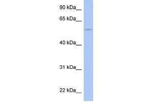 WB Suggested Anti-TRIM58 Antibody Titration: 0. (TRIM58 anticorps  (Middle Region))