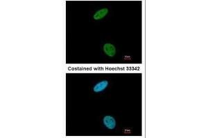 ICC/IF Image Immunofluorescence analysis of paraformaldehyde-fixed HeLa, using CDK6, antibody at 1:200 dilution. (CDK6 anticorps)