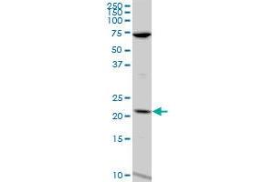LCN1 polyclonal antibody (A01), Lot # 060814QCS1. (Lipocalin 1 anticorps  (AA 24-120))