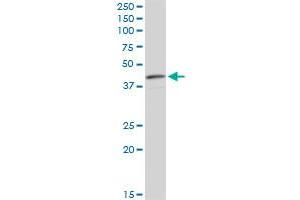 CNN3 monoclonal antibody (M01), clone 4C4.