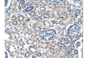 PPAT antibody was used for immunohistochemistry at a concentration of 4-8 ug/ml. (PPAT anticorps  (N-Term))