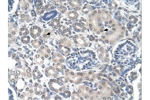PPAT antibody was used for immunohistochemistry at a concentration of 4-8 ug/ml.