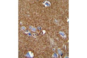 Immunohistochemistry (IHC) image for anti-ATPase, Na+/K+ Transporting, alpha 2 Polypeptide (ATP1A2) antibody (ABIN3002454) (ATP1A2 anticorps)