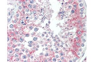 Anti-TCTE3 antibody IHC staining of human testis. (TCTE3 anticorps  (N-Term))