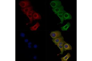 Phospho-ABCA1 (Ser2054) Antibody staining Hela cells(heat shock treatment) by IF/ICC. (ABCA1 anticorps  (pSer2054))