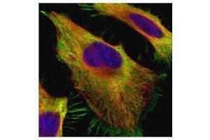 ICC/IF Image Confocal immunofluorescence analysis (Olympus FV10i) of paraformaldehyde-fixed HeLa, using alpha Actin (smooth muscle), antibody (Green) at 1:500 dilution.