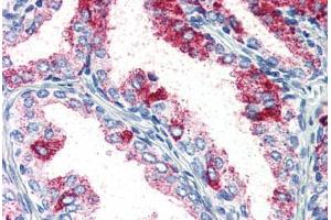 Prostate, Human: Formalin-Fixed, Paraffin-Embedded (FFPE)