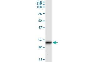 Immunoprecipitation of GUK1 transfected lysate using anti-GUK1 monoclonal antibody and Protein A Magnetic Bead , and immunoblotted with GUK1 MaxPab rabbit polyclonal antibody.