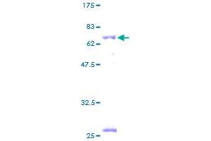 Image no. 1 for Branched Chain Keto Acid Dehydrogenase E1, beta Polypeptide (BCKDHB) (AA 1-392) protein (GST tag) (ABIN1346529)