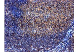 Image no. 8 for anti-Iduronate 2-Sulfatase (IDS) antibody (ABIN1498798)