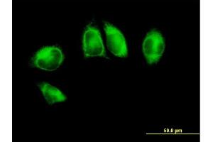Immunofluorescence of purified MaxPab antibody to POR on HeLa cell. (POR anticorps  (AA 1-680))