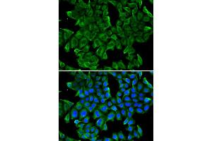 Immunofluorescence analysis of MCF-7 cells using REG3G antibody. (REG3g anticorps)