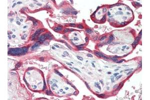 Human Placenta (formalin-fixed, paraffin-embedded) stained with GH1at 10 µg/ml followed by biotinylated goat anti-rabbit IgG secondary antibody, alkaline phosphatase-streptavidin and chromogen. (Growth Hormone 1 anticorps)