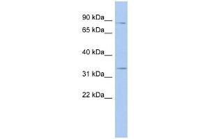 Syntaxin 19 antibody used at 1 ug/ml to detect target protein. (Syntaxin 19 anticorps  (N-Term))
