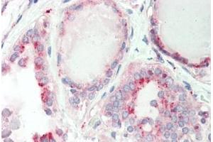 Haman, Thyroid: Foramlin-Fixed Paraffin-Embedded (FFPE) (GATAD1 anticorps  (C-Term))