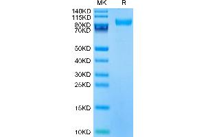 CD180 Molecule (CD180) (AA 21-626) protein (His tag)