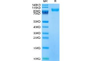 Mouse CD180 on Tris-Bis PAGE under reduced condition. (CD180 Protein (AA 21-626) (His tag))