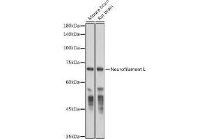 Western blot analysis of extracts of various cell lines, using Neurofilament L antibody (ABIN7268867) at 1:50000 dilution. (NEFL anticorps)