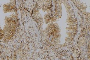 ABIN6278575 at 1/100 staining Mouse colon tissue by IHC-P. (GLYCTK anticorps  (Internal Region))