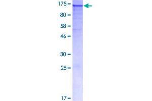 Image no. 1 for Desmoglein 1 (DSG1) (AA 1-1049) protein (GST tag) (ABIN1352036)
