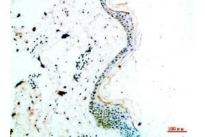 Immunohistochemical analysis of paraffin-embedded human-skin, antibody was diluted at 1:200 (COL14A1 anticorps  (AA 1571-1620))