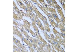 Immunohistochemistry of paraffin-embedded human liver using CAD antibody (ABIN5974557) at dilution of 1/100 (40x lens). (CAD anticorps)