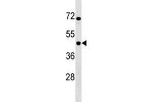 IKBIP antibody western blot analysis in Jurkat lysate. (IKbIP anticorps  (AA 319-345))