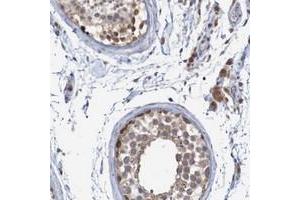 Immunohistochemical staining of human testis with ANKK1 polyclonal antibody  shows cytoplasmic positivity in cells in seminiferus ducts and leydig cells. (ANKK1 anticorps)
