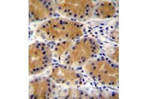 Immunohistochemistry analysis in formalin fixed and paraffin embedded human stomach tissue reacted with PLEKHG3 Antibody (C-term) followed which was peroxidase conjugated to the secondary antibody and followed by DAB staining.