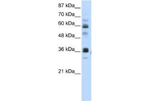 WB Suggested Anti-RPUSD2 Antibody Titration:  5. (RPUSD2 anticorps  (N-Term))