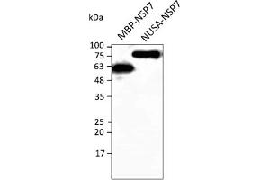 Western Blotting (WB) image for anti-SARS-CoV-2 Non-Structural Protein 7 (NSP7) antibody (ABIN7273019) (SARS-CoV-2 NSP7 anticorps)