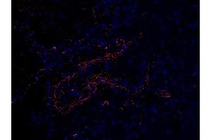 Immunofluoorescent l analysis of paraffin-embedded COVID-19 patient lung tissue using anti- SARS-CoV-2 (COVID-19) Envelope antibody (ABIN1031551, 2 μg/mL). (SARS-CoV-2 Envelope anticorps  (N-Term))