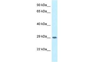 WB Suggested Anti-SIRPG Antibody Titration: 1. (SIRPG anticorps  (Middle Region))