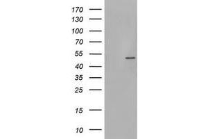Image no. 1 for anti-phosphorylase Kinase, gamma 2 (Testis) (PHKG2) (AA 1-216) antibody (ABIN1490613) (PHKG2 anticorps  (AA 1-216))