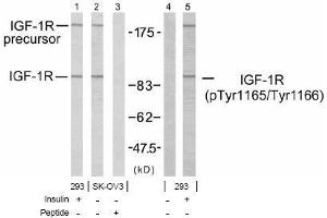 Image no. 1 for anti-Insulin-Like Growth Factor 1 Receptor (IGF1R) (pTyr1165), (pTyr1166) antibody (ABIN197244) (IGF1R anticorps  (pTyr1165, pTyr1166))