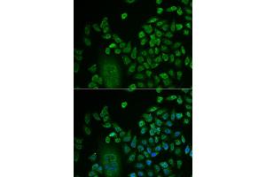 Immunofluorescence (IF) image for anti-LSM4 Homolog, U6 Small Nuclear RNA Associated (LSM4) antibody (ABIN1980258) (LSM4 anticorps)