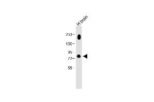 Anti-K5 Antibody at 1:2000 dilution + Human brain lysate Lysates/proteins at 20 μg per lane.
