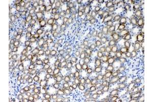 IHC testing of FFPE rat kidney tissue with RPS6 antibody at 1ug/ml. (RPS6 anticorps  (AA 13-52))