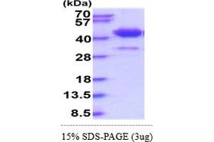 SDS-PAGE (SDS) image for Surfactant Protein D (SFTPD) (AA 22-375) protein (His tag) (ABIN5855095)