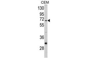 Western blot analysis of ND5 Antibody (C-term) in CEM cell line lysates (35ug/lane). (MT-ND5 anticorps  (C-Term))