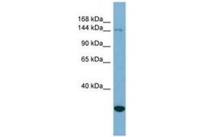 Image no. 1 for anti-Jumonji, AT Rich Interactive Domain 2 (JARID2) (AA 215-264) antibody (ABIN6741955) (JARID2 anticorps  (AA 215-264))