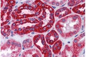 Human Kidney: Formalin-Fixed, Paraffin-Embedded (FFPE) (COX6B1 anticorps  (AA 1-87))