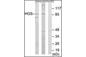 Western blot analysis of extracts from 293/HuvEc cells, using HGS Antibody. (HGS anticorps  (Internal Region))