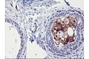 Immunohistochemical staining of paraffin-embedded Human breast tissue using anti-SDS mouse monoclonal antibody. (serine Dehydratase anticorps)